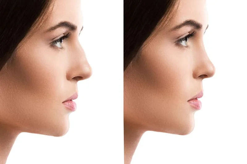 Cirujano plástico vs maxilofacial: diferencias y cuándo acudir en Tijuana